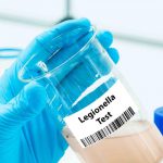 Muestra de agua con una etiqueta de Legionella Test