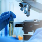 Unas manos con guantes de latex azul sostienen una muestra al lado de un microscopio